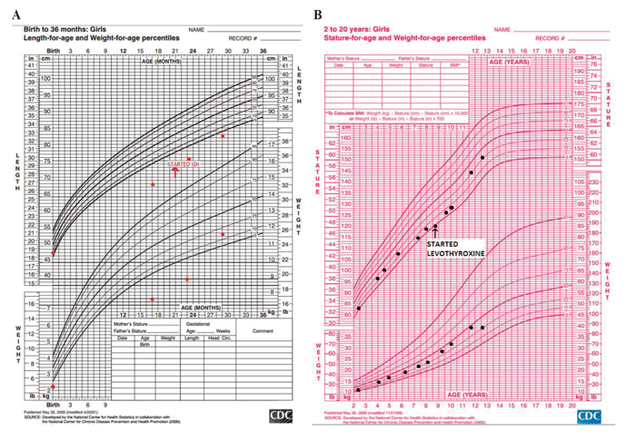 Growth Hormone Deficiency Growth Chart