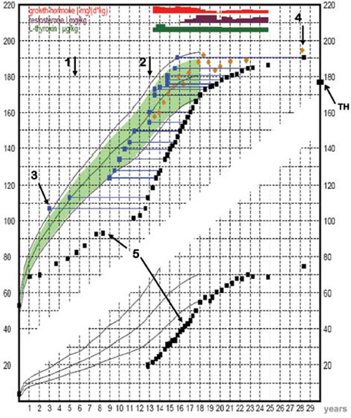 Growth Hormone Deficiency Growth Chart