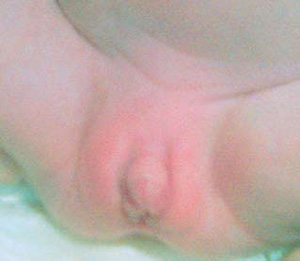 large clitoris pics